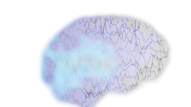 brain with graph lines and cloud inside