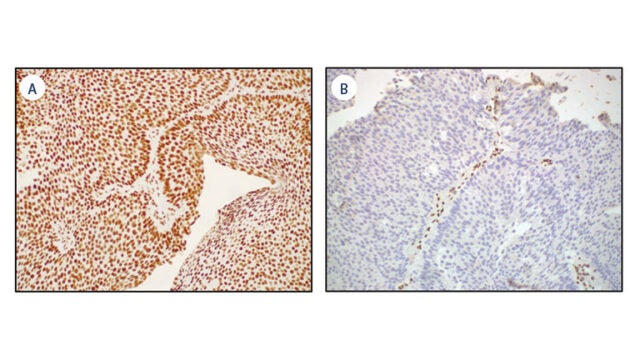 medical imaging of bladders