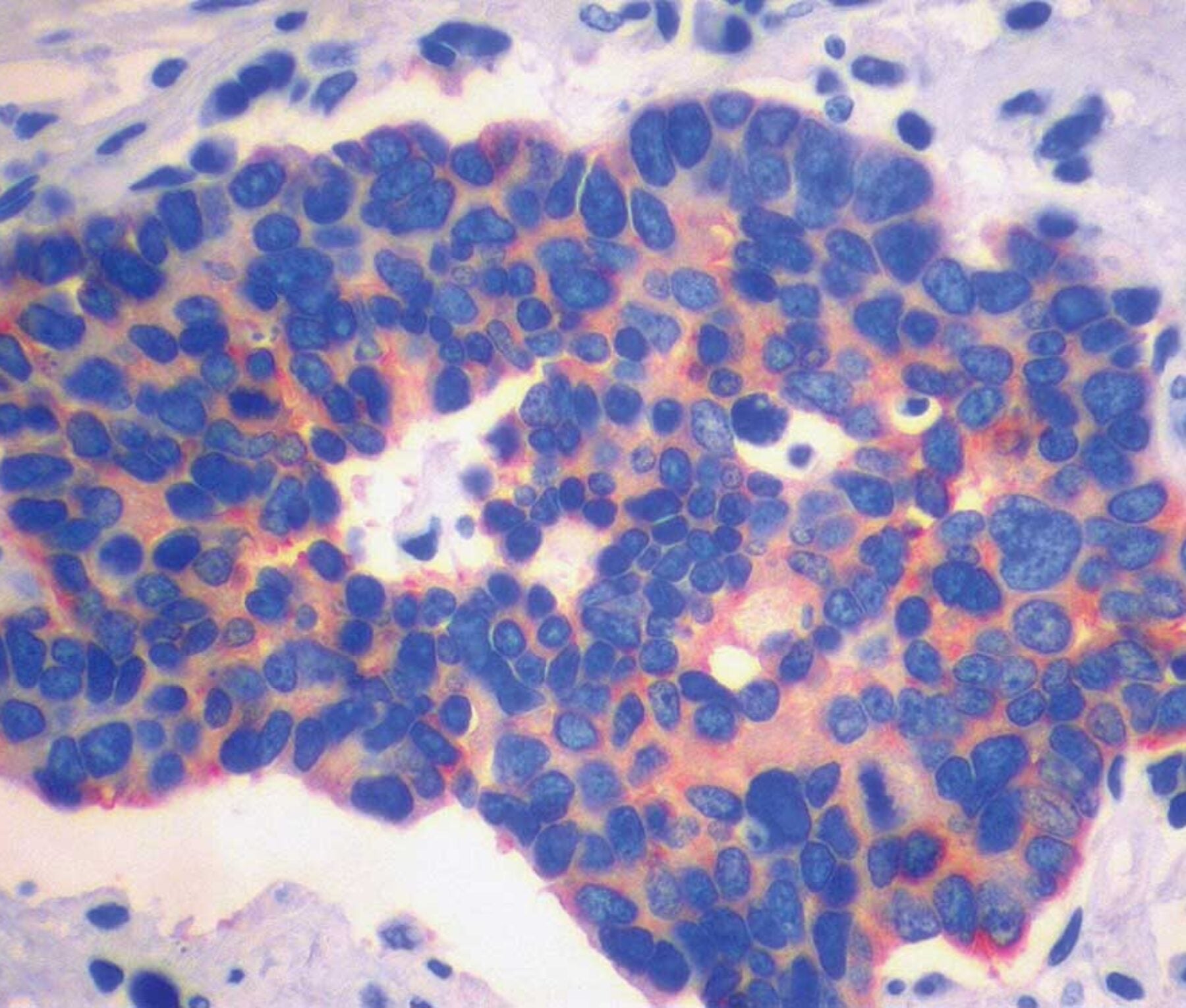 small lung cancer cells