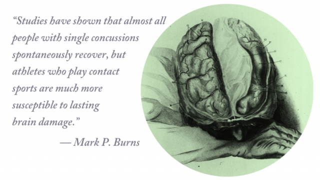 sketch of brain with words next to it that say: 